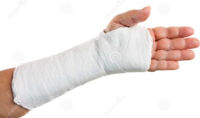 Broken arm in a cast.