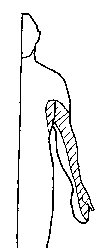 Area of the body affected by carpal tunnel syndrome.